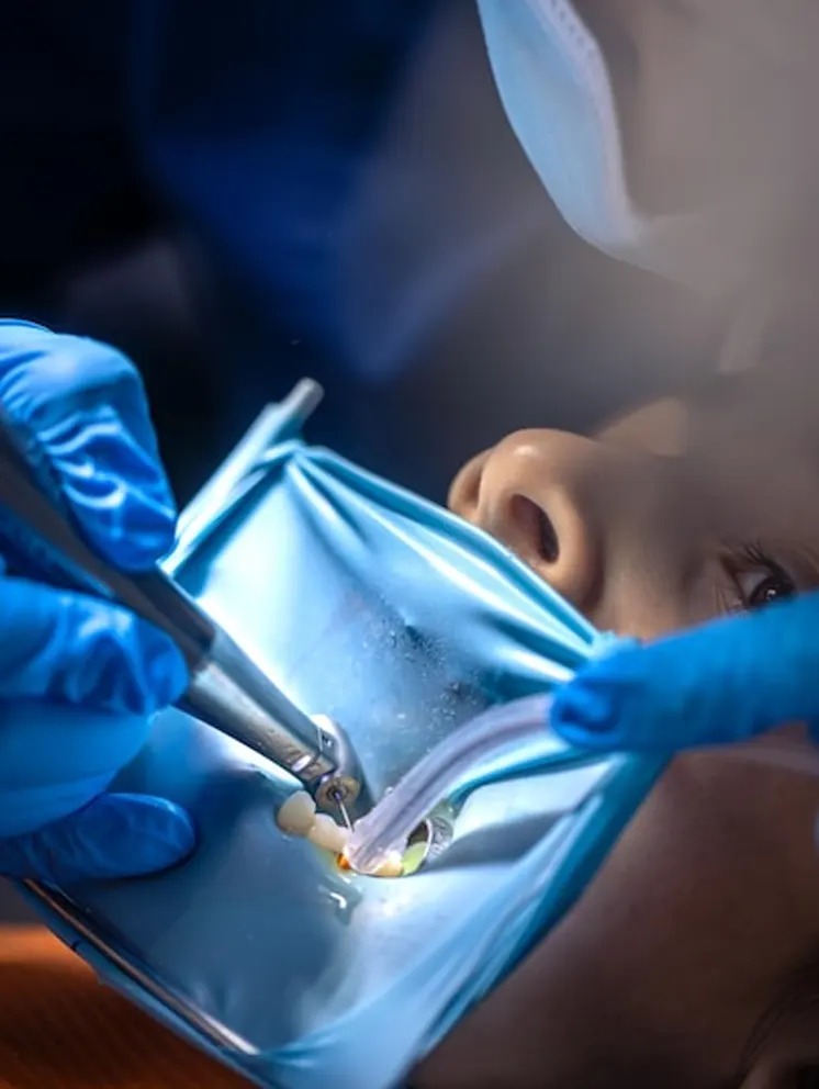 Chirurgie dentară-home